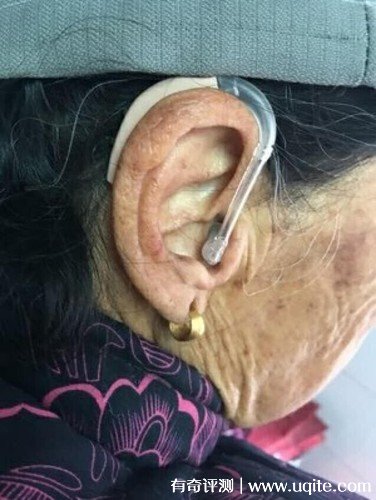 西門子助聽器怎么樣多少錢一個，親自使用體驗(價格328元)