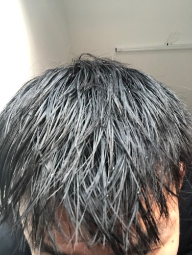 有情生姜洗發水是真的好有效嗎多少錢，防脫發效果親測(僅19.9元)
